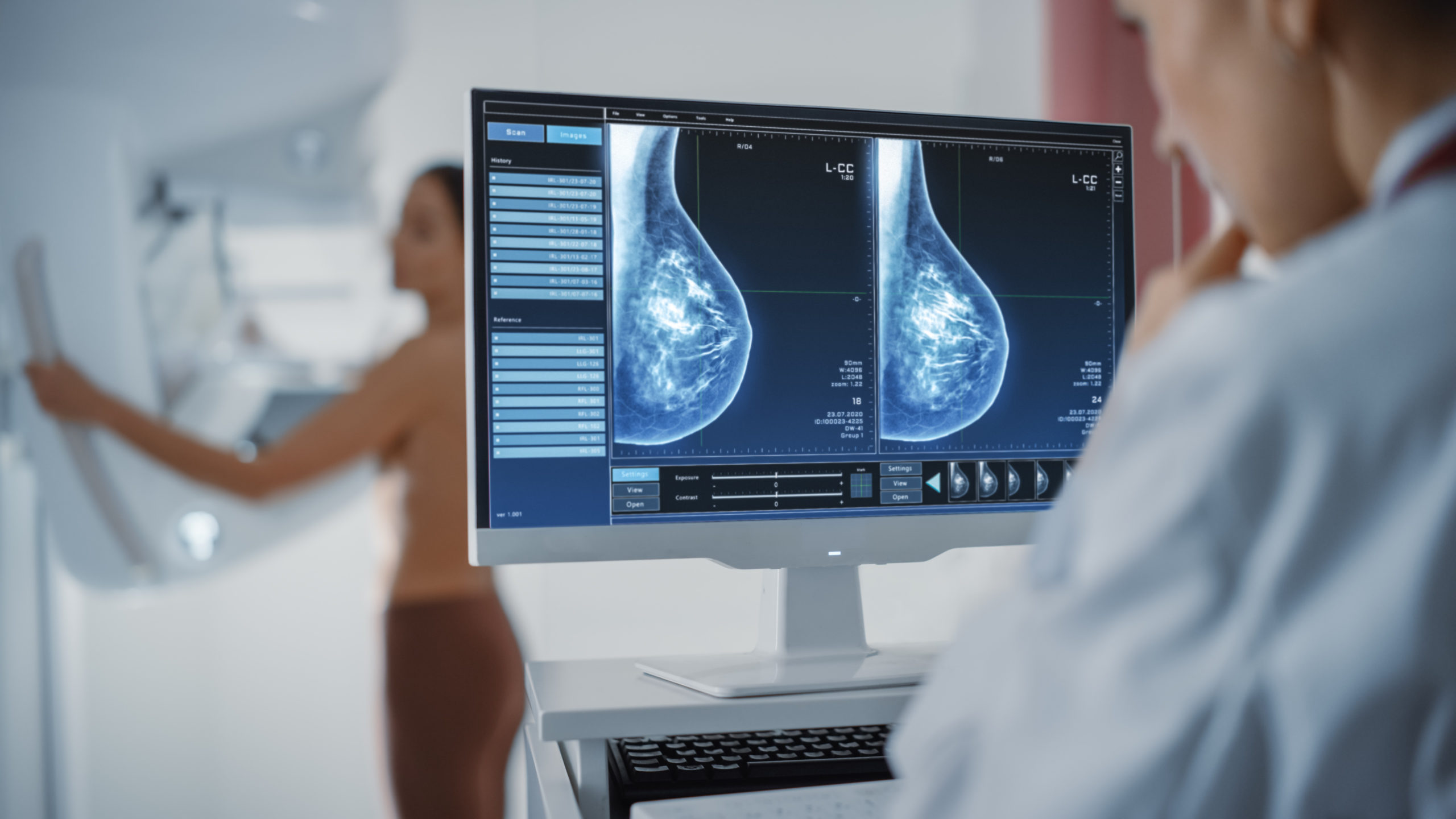 Is Mammography Testing the Right Choice for You?