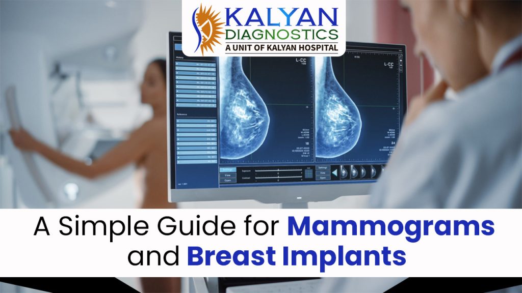 A Simple Guide for Mammograms and Breast Implants